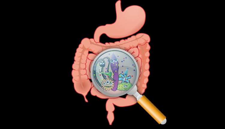 Krebstherapie- Das Mikrobiom spielt eine wichtige Rolle